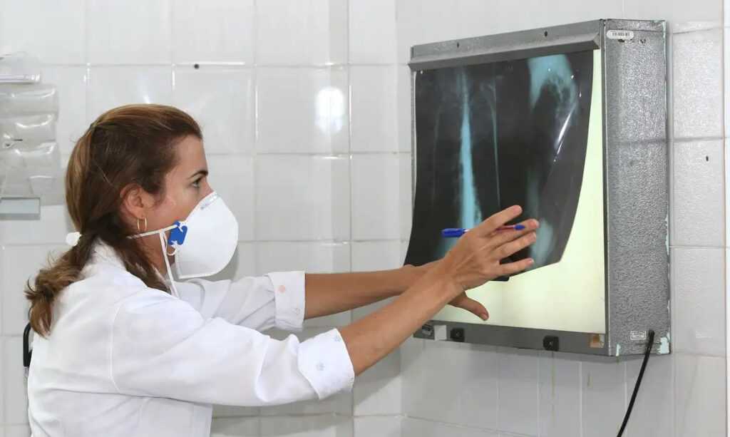 Dia Mundial de Enfrentamento à Tuberculose reforça importância do diagnóstico precoce dia-mundial-de-combate-a-tuberculose-reforca-importancia-do-diagnostico-precoce